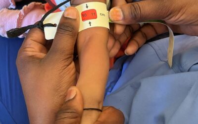 AcDev dans la lutte contre la malnutrition : 300 enfants dépistés en deux jours dans le district de Keur Massar